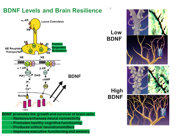 BDNF Depression - Drbrucekehr.com